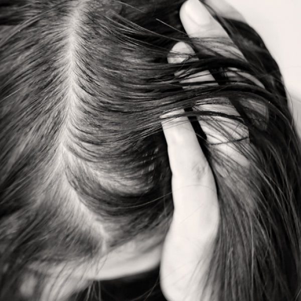 Hair Loss