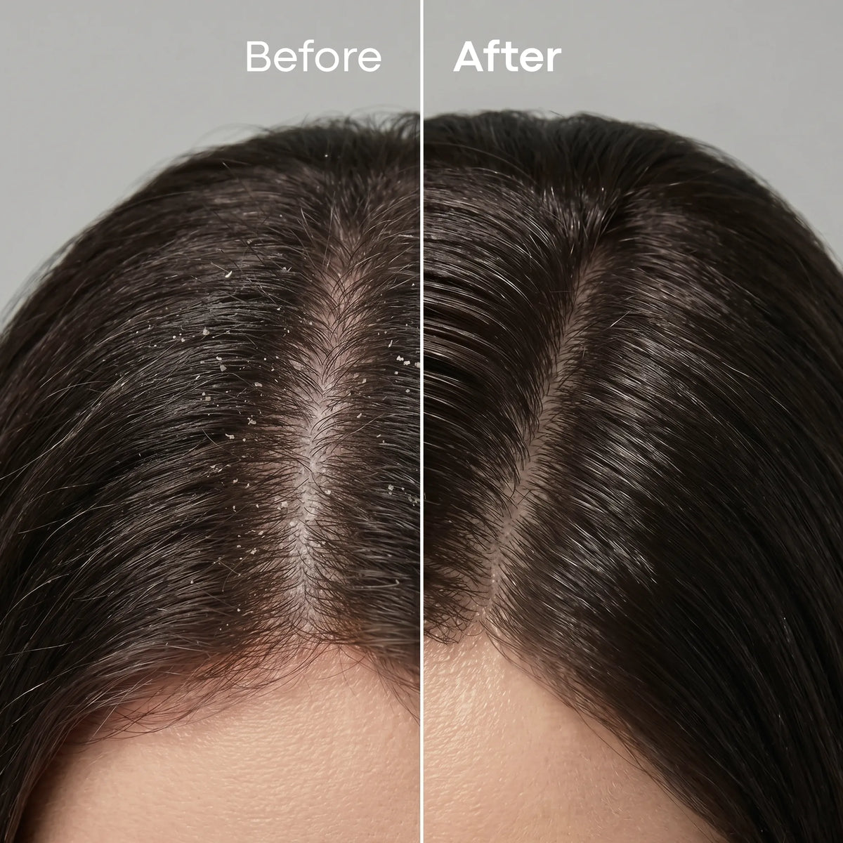 LAVAL Ayurveda Anti Dandruff Hair Mask