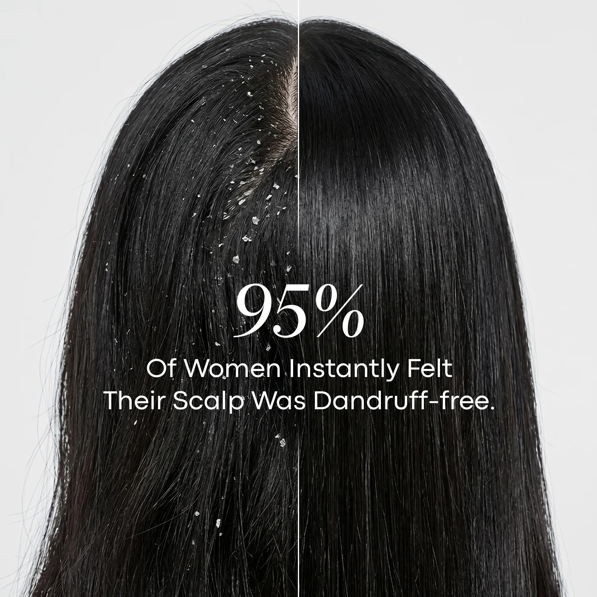LAVAL Ayurveda Anti Dandruff Hair Mask