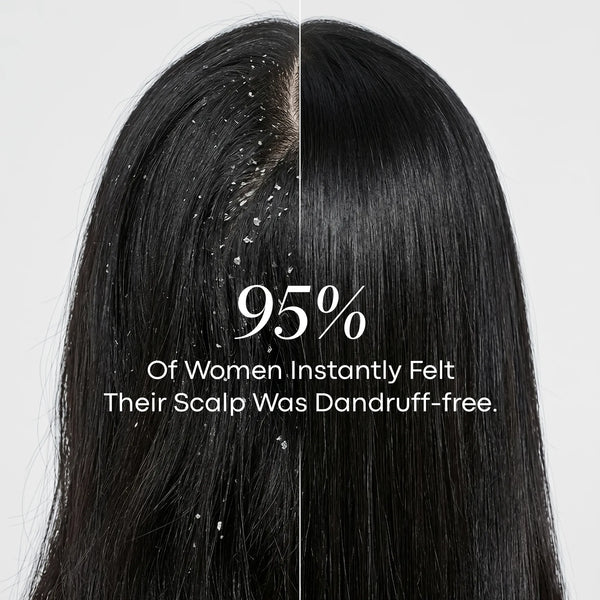 LAVAL Ayurveda Anti Dandruff Hair Mask