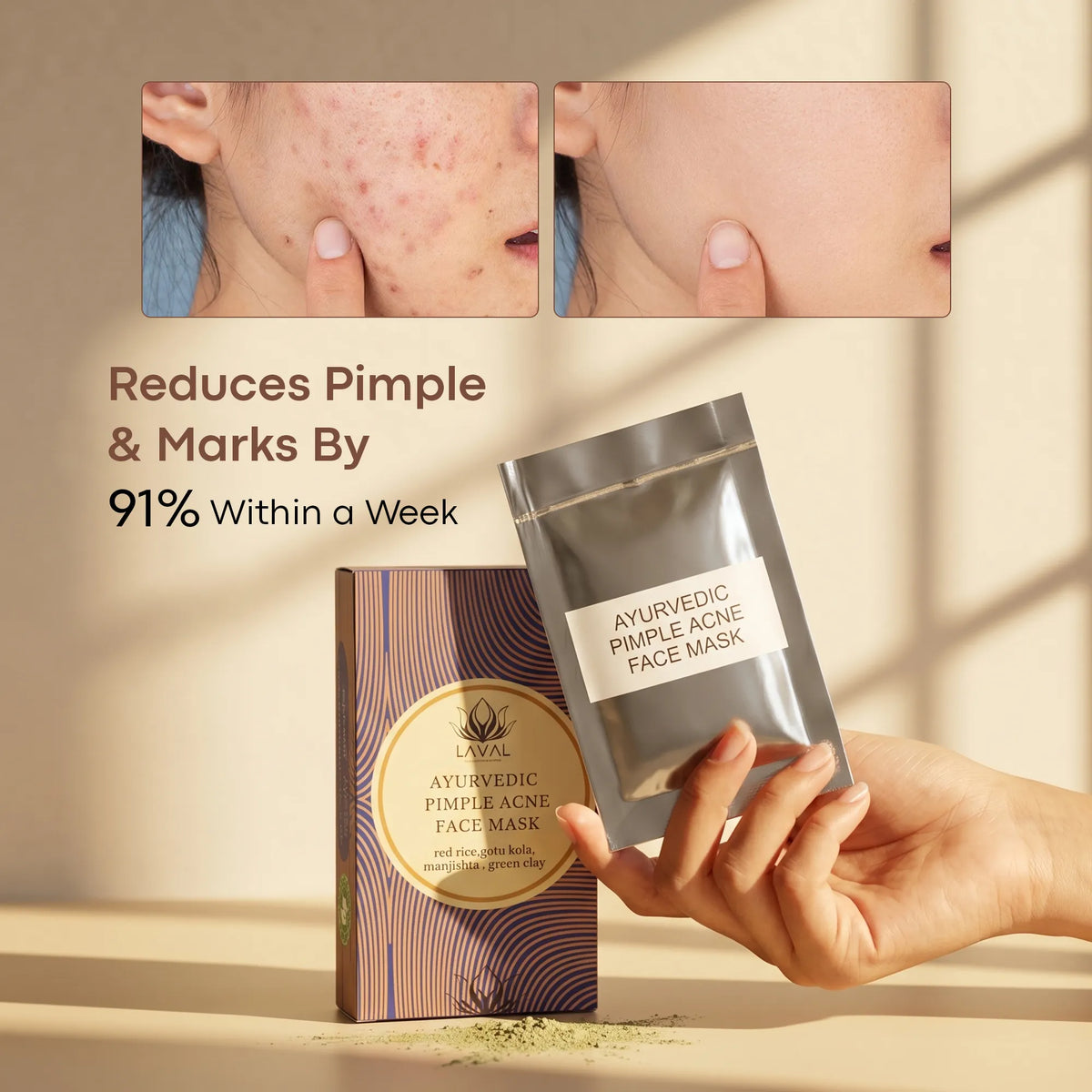LAVAL Ayurveda Pimple Face Mask